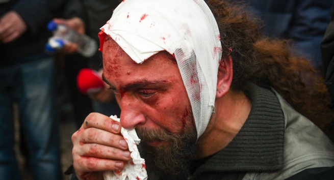 Фотожурналисты рассказали что у нападавших было фото Костиса Дадамиса