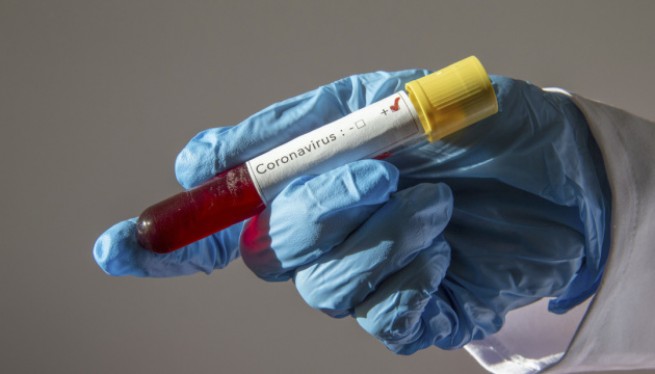 Циодрас о тестах на коронавирус: тесты на антитела не гарантируют правильный результат