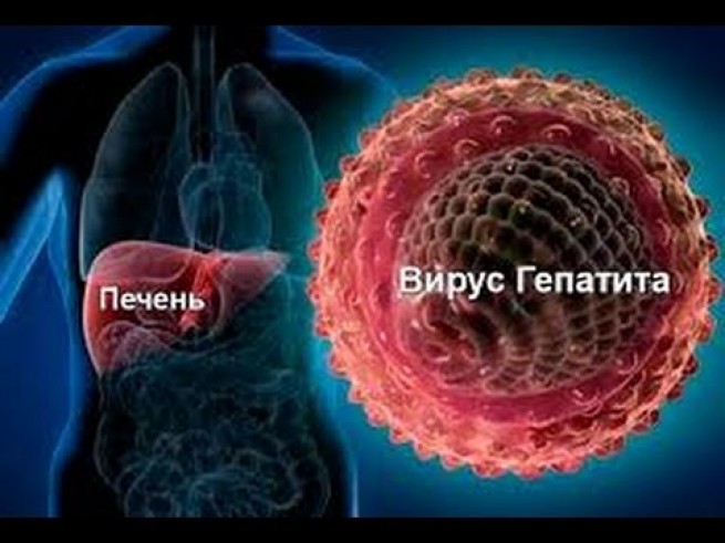 Греция: 75.000 человек с гепатитом С не знают о том, что больны