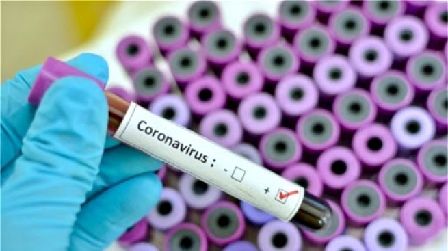 Экстренные меры противодействия эпидемии коронавируса в Греции